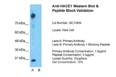 Western Blot: HACE1 Antibody [NBP1-55062]