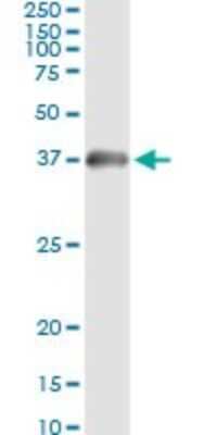Immunoprecipitation: HADH Antibody (4B5) [H00003033-M01]