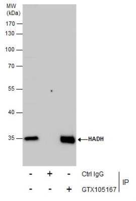 Immunoprecipitation: HADH Antibody [NBP2-16776]