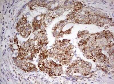Immunohistochemistry: HADH Antibody (OTI3D12) - Azide and BSA Free [NBP2-70875]
