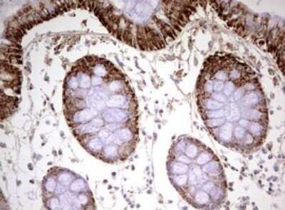 Immunohistochemistry: HADH Antibody (OTI3D12) - Azide and BSA Free [NBP2-70875]