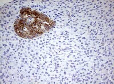Immunohistochemistry: HADH Antibody (OTI3D12) - Azide and BSA Free [NBP2-70875]