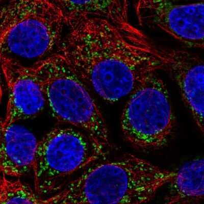 Immunocytochemistry/ Immunofluorescence: HADHA Antibody [NBP2-54988]