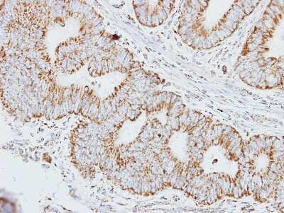 Immunohistochemistry-Paraffin: HADHA Antibody [NBP1-33588]