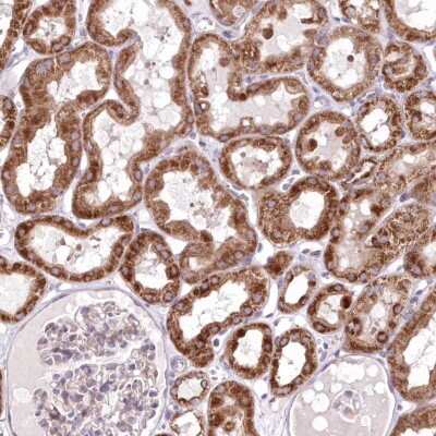 Immunohistochemistry-Paraffin: HADHB Antibody [NBP2-38353]