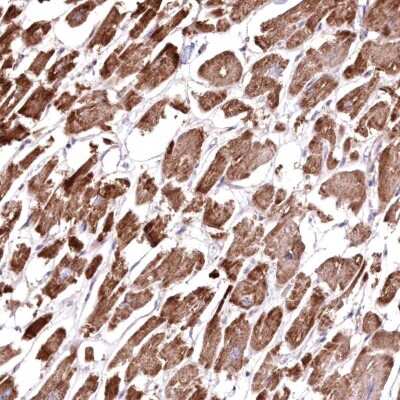 Immunohistochemistry-Paraffin: HADHB Antibody [NBP2-38353]