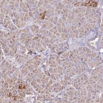 Immunohistochemistry-Paraffin: HADHB Antibody [NBP2-38353]