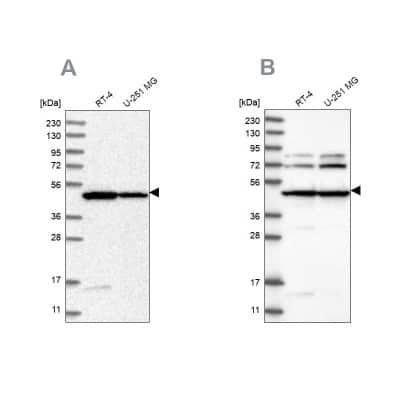 Western Blot: HADHB Antibody [NBP2-38353]