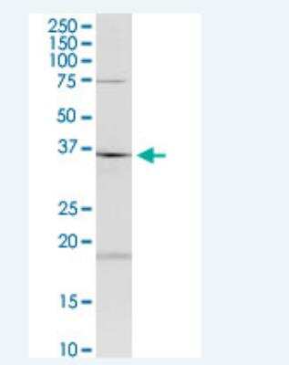 Western Blot: HAGHL Antibody (5B12) [H00084264-M01-100ug]