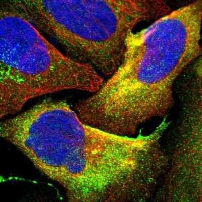 Immunocytochemistry/ Immunofluorescence: HAI-1/HGFA Inhibitor 1 Antibody [NBP1-89720]