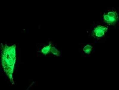 Immunocytochemistry/ Immunofluorescence: HAI-1/HGFA Inhibitor 1 Antibody (OTI4H2) - Azide and BSA Free [NBP2-71296]