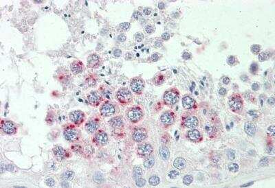 Immunohistochemistry-Paraffin: HAI-2/SPINT2 Antibody [NBP1-52068]
