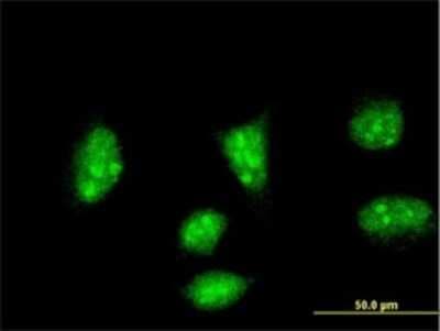 Immunocytochemistry/ Immunofluorescence: HAND2 Antibody (3E3) [H00009464-M03]