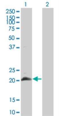 Western Blot: HAND2 Antibody (4E12) [H00009464-M04]