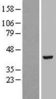 Western Blot: Hydroxyacid Oxidase-1/HAO-1 Overexpression Lysate [NBP2-06960]