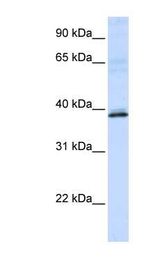 Western Blot: HAO2 Antibody [NBP1-53164]