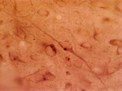 Immunohistochemistry: HAP1 Antibody (1B6) - Azide and BSA Free [NBP2-80758]