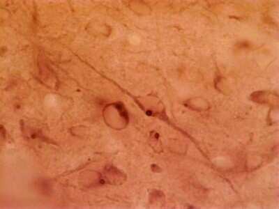 Immunohistochemistry: HAP1 Antibody (1B6) [NB110-74569]