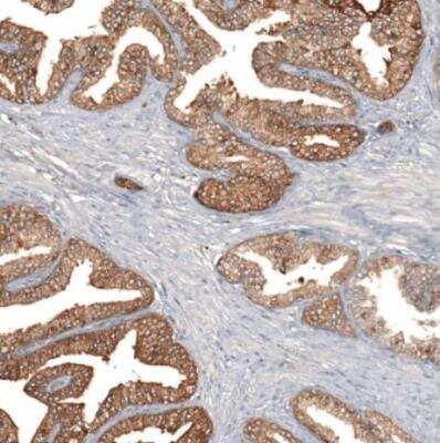 Immunohistochemistry-Paraffin: HAP40 Antibody [NBP2-54731]