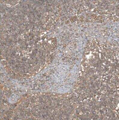 Immunohistochemistry-Paraffin: HAP40 Antibody [NBP2-54731]