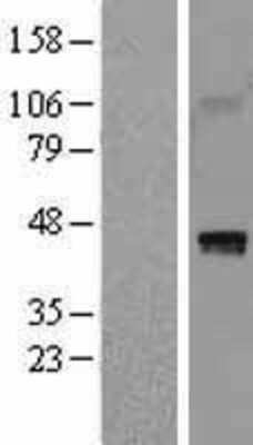 Western Blot: HAPLN1 Overexpression Lysate [NBL1-11444]