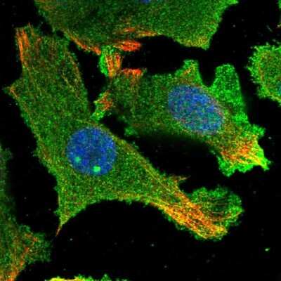 Immunocytochemistry/ Immunofluorescence: HARBI1 Antibody [NBP2-55680]