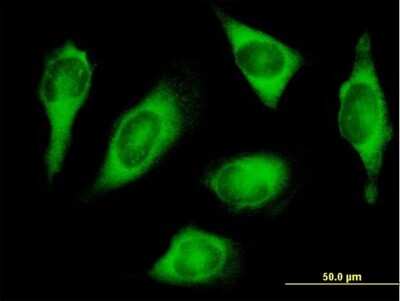 Immunocytochemistry/ Immunofluorescence: HARS Antibody [H00003035-B01P]