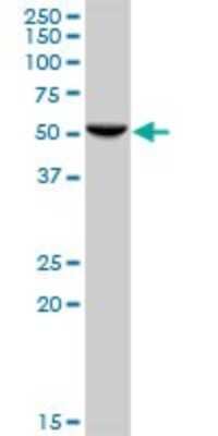 Western Blot: HARS Antibody [H00003035-B01P]