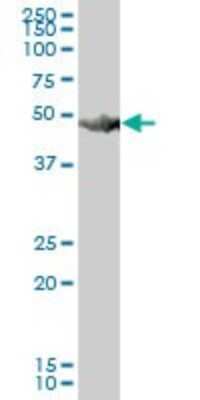 Western Blot: HARS Antibody [H00003035-B01P]