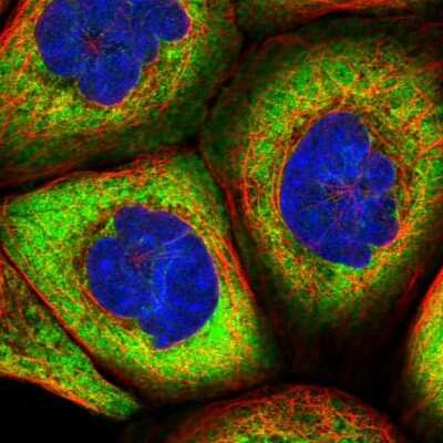 Immunocytochemistry/ Immunofluorescence: HARS2 Antibody [NBP1-81775]
