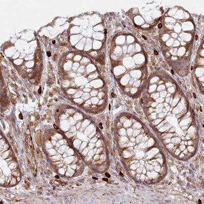 Immunohistochemistry: HARS2 Antibody [NBP1-81775]