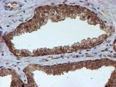 Immunohistochemistry: HARS2 Antibody (OTI5H2) - Azide and BSA Free [NBP2-71739]