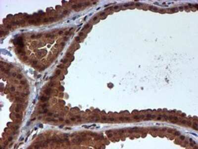 Immunohistochemistry: HARS2 Antibody (OTI5H2) - Azide and BSA Free [NBP2-71739]