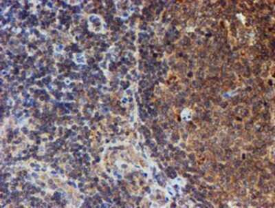 Immunohistochemistry: HARS2 Antibody (OTI5H2) - Azide and BSA Free [NBP2-71739]
