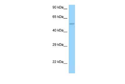 Western Blot: HARS2 Antibody [NBP2-85026]