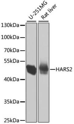 Western Blot: HARS2 AntibodyBSA Free [NBP3-04858]