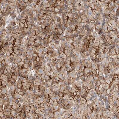 Immunohistochemistry-Paraffin: HAUS4 Antibody [NBP1-90722]