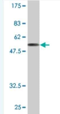 Western Blot: HAX-1 Antibody (2B12) [H00010456-M11]