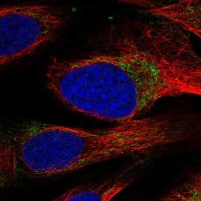 Immunocytochemistry/ Immunofluorescence: HAX-1 Antibody [NBP2-57945]