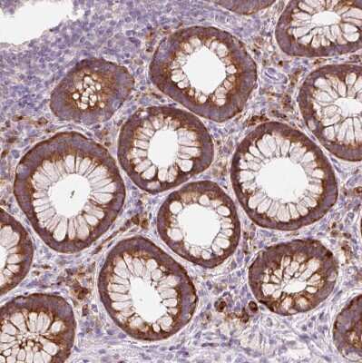 Immunohistochemistry-Paraffin: HAX-1 Antibody [NBP2-49169]