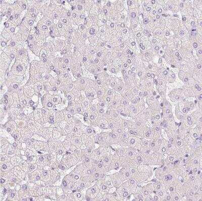 Immunohistochemistry-Paraffin: HAX-1 Antibody [NBP2-49169]