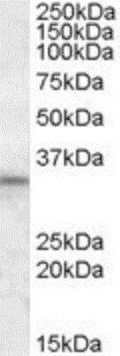 Western Blot: HAX-1 Antibody [NBP1-28796]