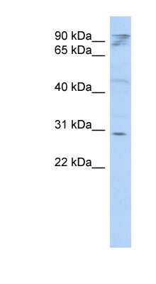 Western Blot: HAX-1 Antibody [NBP1-54800]
