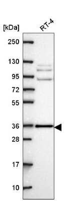 Western Blot: HAX-1 Antibody [NBP2-57945]