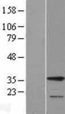 Western Blot: HAX-1 Overexpression Lysate [NBL1-11453]