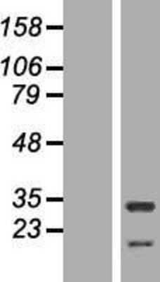 Western Blot: HAX-1 Overexpression Lysate [NBP2-08669]