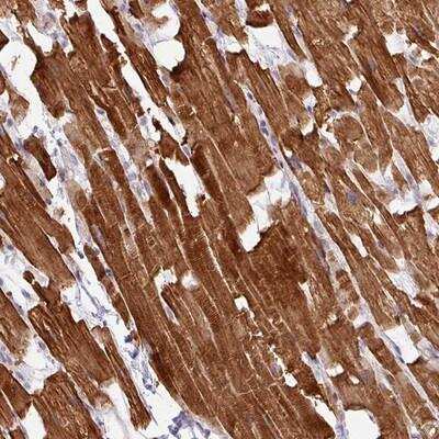 Immunohistochemistry-Paraffin: HB-EGF Antibody [NBP2-14082]