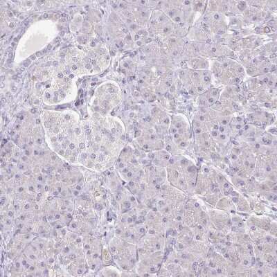 Immunohistochemistry-Paraffin: HB-EGF Antibody [NBP2-14082]
