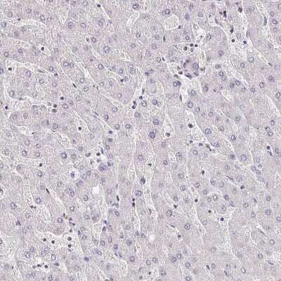 Immunohistochemistry-Paraffin: HB-EGF Antibody [NBP2-14082]