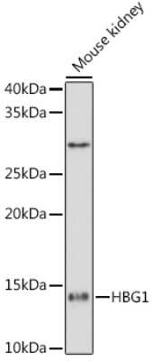 Western Blot: HBG1 Antibody (6F1A8) [NBP3-15299]